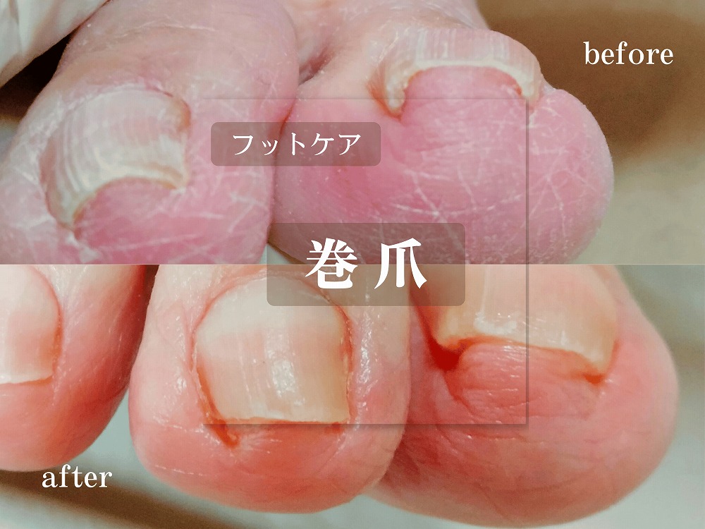 施術事例
