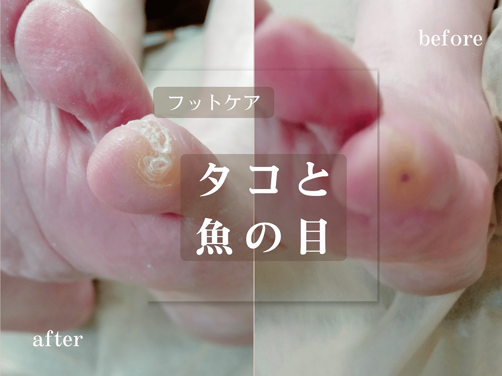 施術事例
