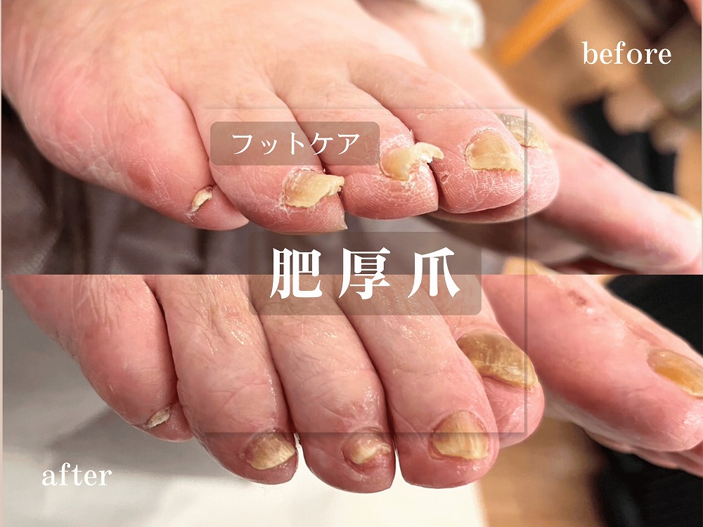 施術事例