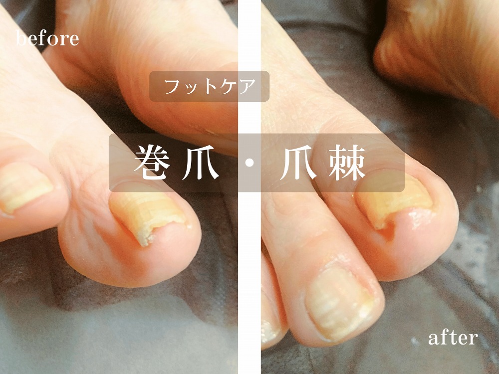施術事例