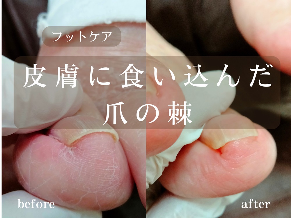 施術事例